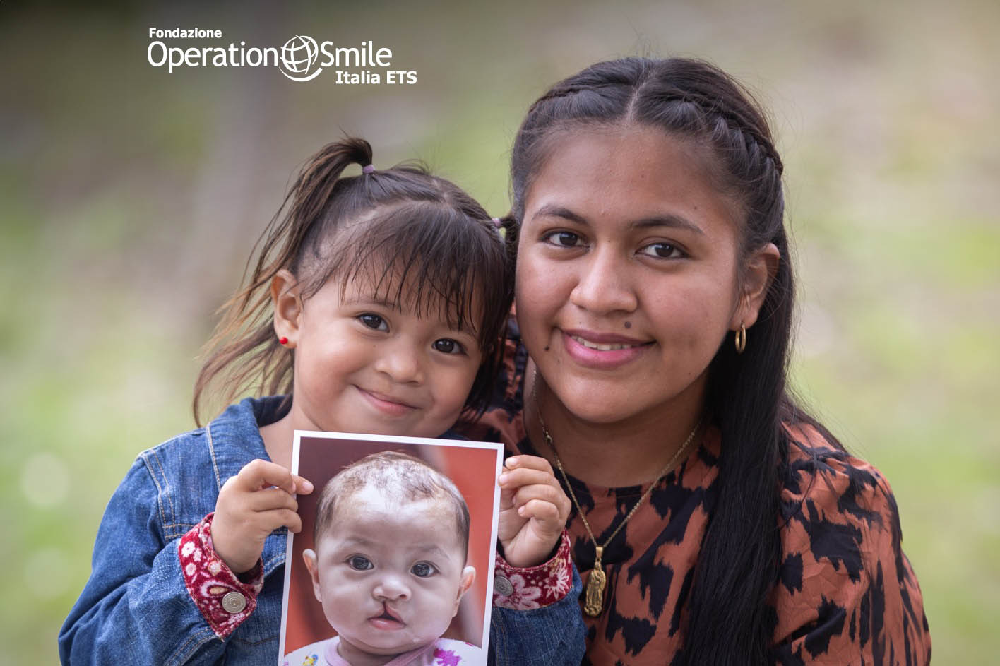 Victoria, nuovo sorriso. Operation Smile