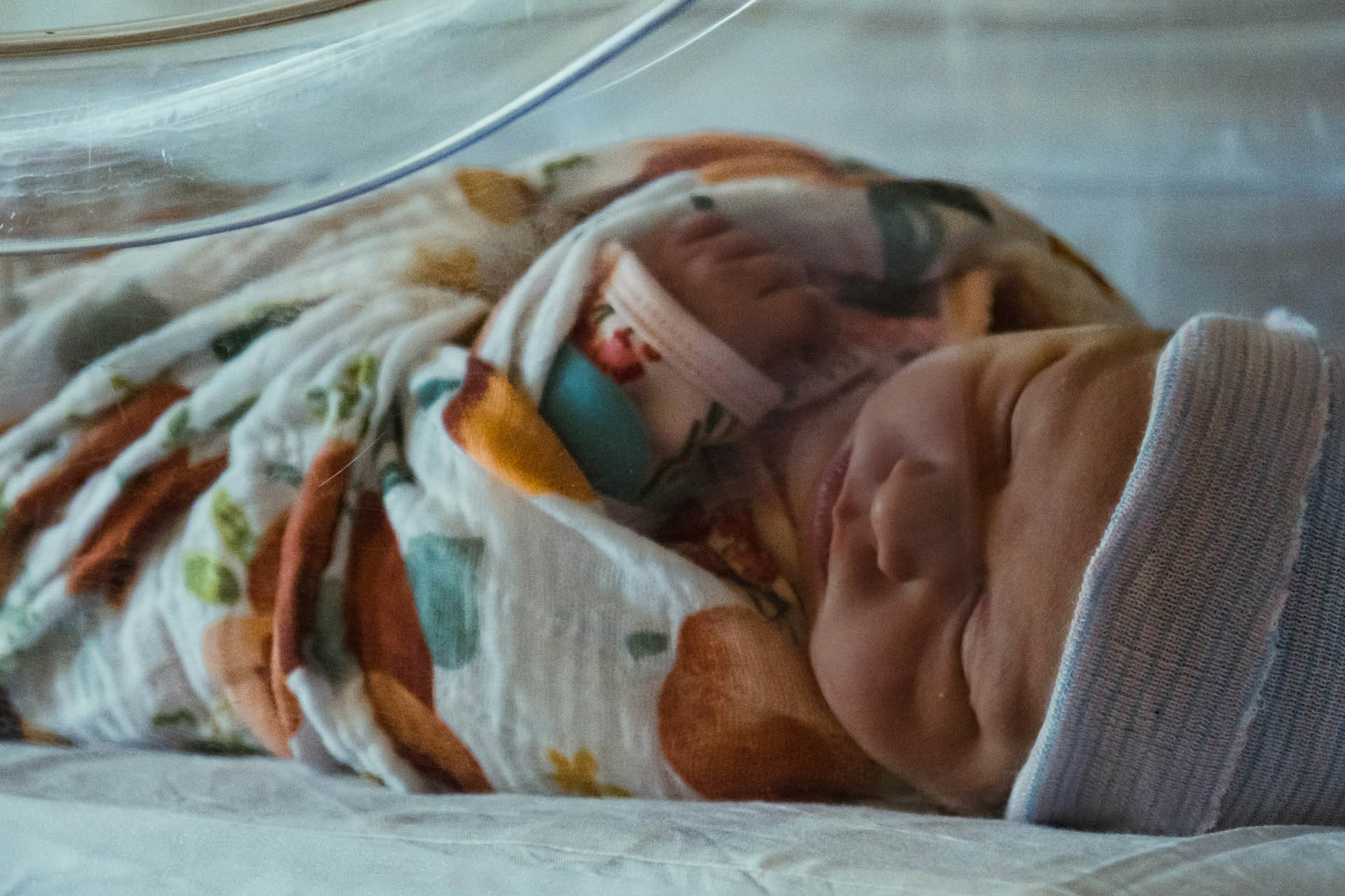 bambini del Guatemala prematuri retinopatia